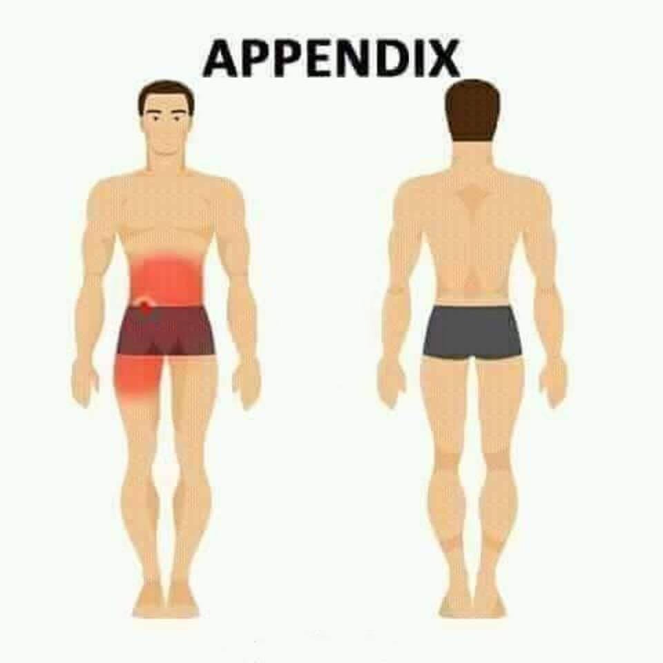 appendix pain