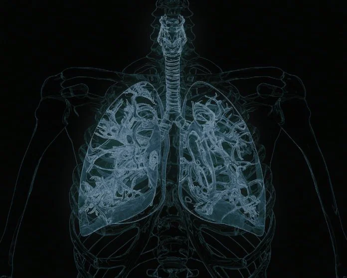 How a Small Testing Delay Can Postpone Lung Cancer Treatment