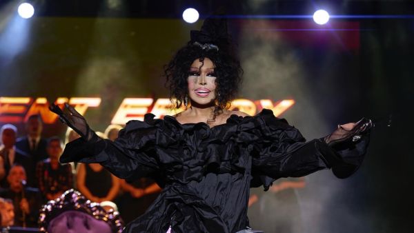 Bülent Ersoy's First Cosmetic Surgery at Age 74: Update