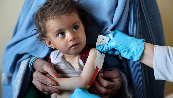 UN: 1 Million Afghan Children Face Critical Malnutrition